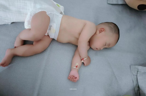 郯城宝宝头上长痱子 郯城宝宝头上长痱子